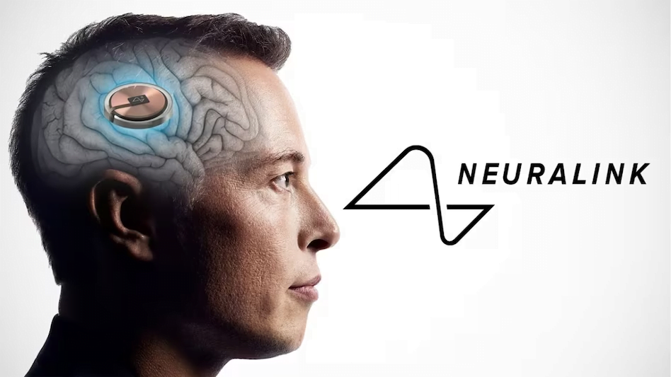 Neuralink di Elon Musk ottiene l'approvazione per studi su esseri umani