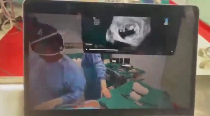 Un intervento di cardiochirurgia svolto a Bari grazie all'ausilio della realtà aumentata dell'Apple Vision Pro ha sostituito una valvola