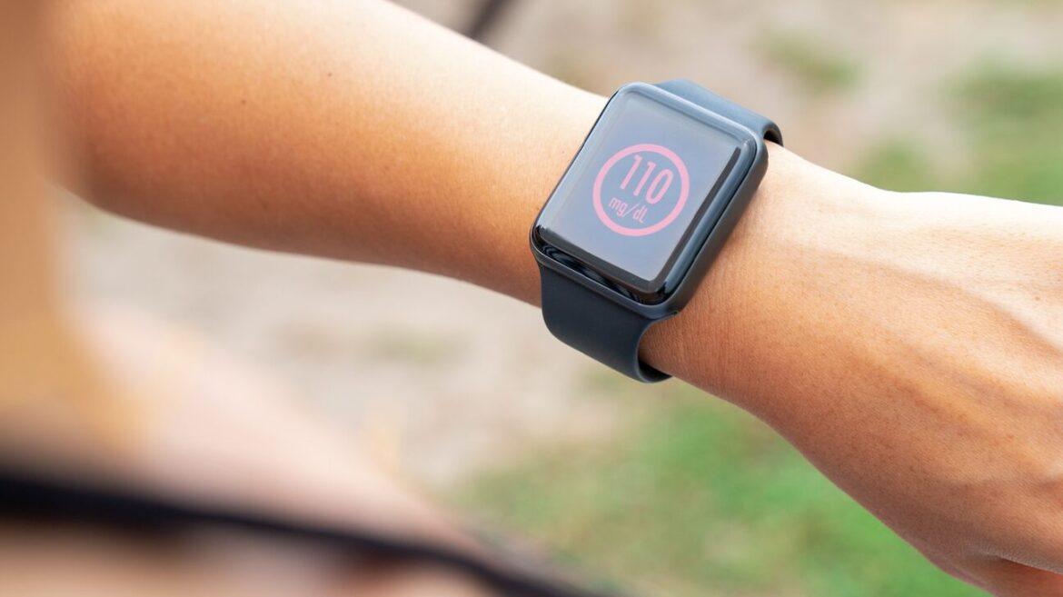 FDA Smartwatch Glucosio FDA Smartwatch Glucosio