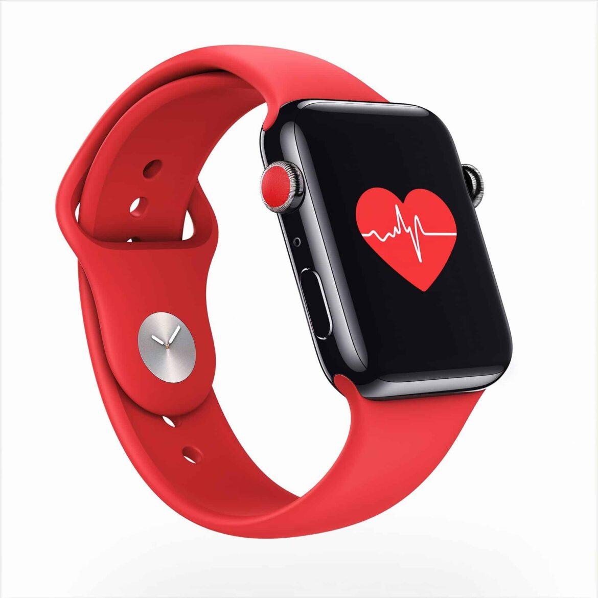 Apple Watch – Salute Cardiaca Apple Watch - Salute Cardiaca