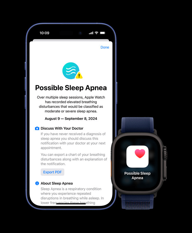 Apple Watch Ultra 2 e Series 10: pronti con watchOS 11 9 image 54