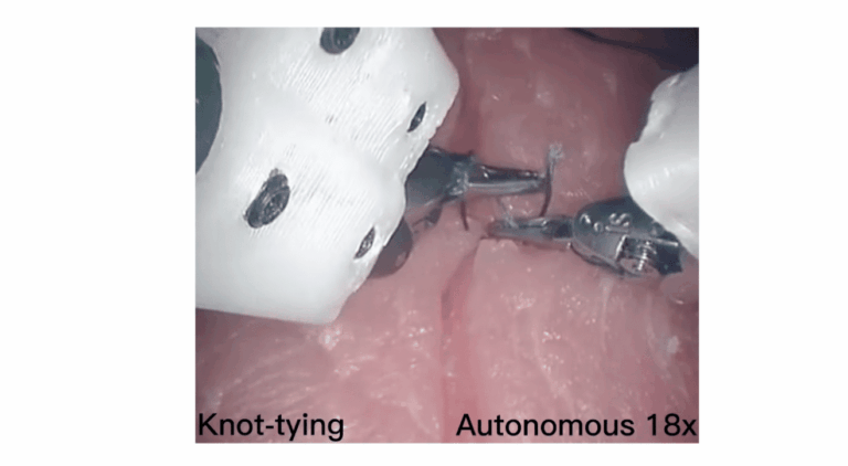 Robot autonomi osservano video e diventano specialisti in chirugia 8 image 169