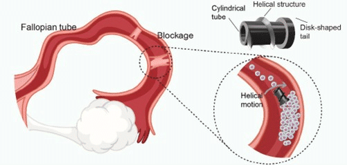Microrobot magnetico nel trattamento dell'infertilità femminile 6 image 300