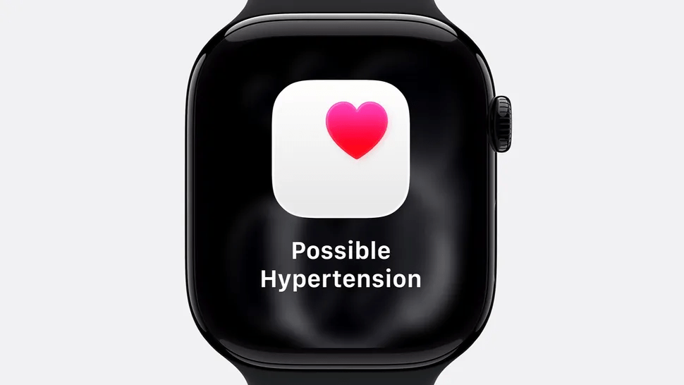 Apple Watch Series 11